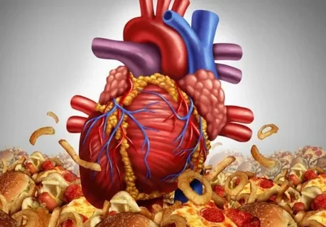 Current Research on How Fat Contributes to Heart Problems